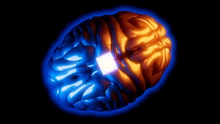 El paciente Noland Arbaugh usa su PC con la mente, sin mover un solo músculo. El paciente Noland Arbaugh usa su PC con la mente, sin mover un solo músculo.