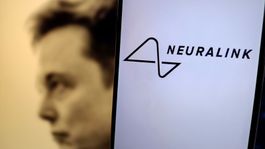 Neuralink: Elon Musk apuesta por los implantes cerebrales