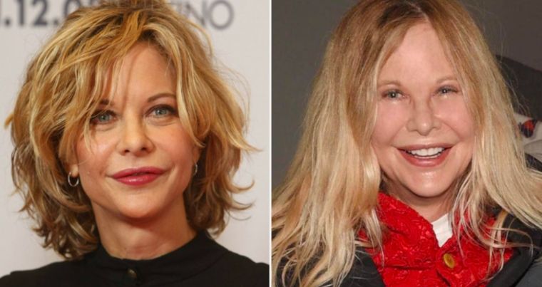 Meg Ryan, duramente criticada por su aspecto físico.