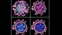 En la superior izquierda, el SARS-CoV-2 en su membrana externa; en la superior derecha se puede observar el ARN; en las imágenes inferiores se puede ver un corte transversal del virus - Fuente: Nanographics