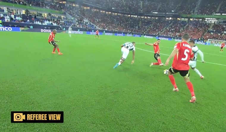 Imagen de referencia de la visión que se obtendrá con la Imagen de referencia de la visión que se obtendrá con la