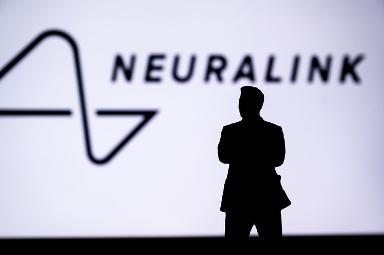 El chip cerebral de Neuralink se implanta con un robot quirúrgico de precisión. El chip cerebral de Neuralink se implanta con un robot quirúrgico de precisión.