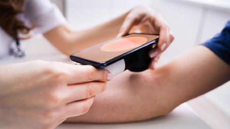 Así es Dermatology Assist, la herramienta de asistencia dermatológica de Google