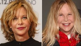 Meg Ryan, duramente criticada por su aspecto físico.