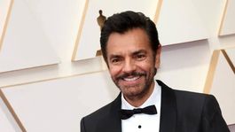 Eugenio Derbez fue operado con éxito después de sufrir un accidente.